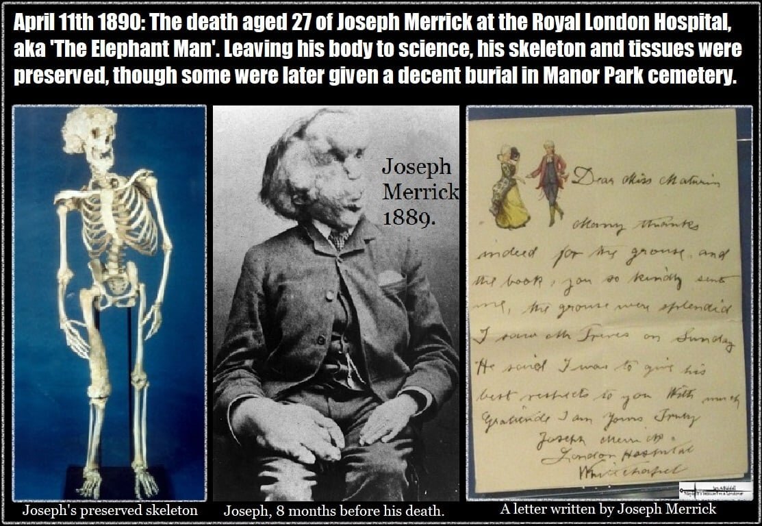 Joseph Merrick The Elephant man.jpg